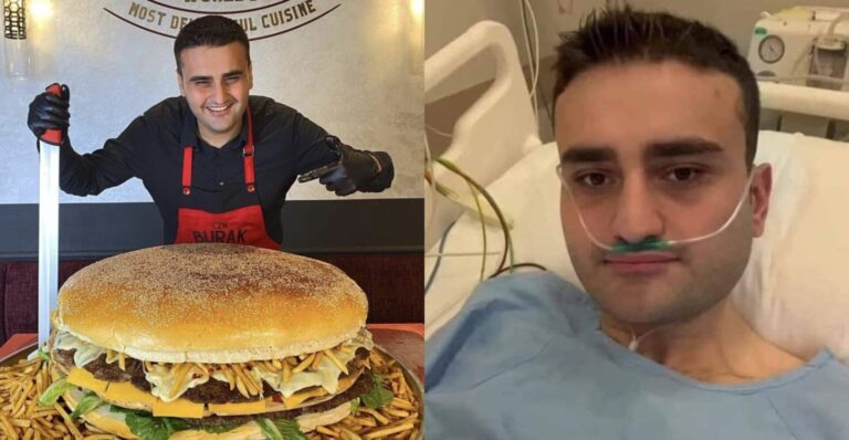 CZN Burak ne souffre pas de tumeur au cerveau, confirme le chef