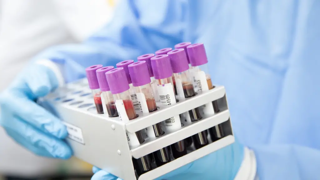 La transfusion sanguine est-elle haram ?
