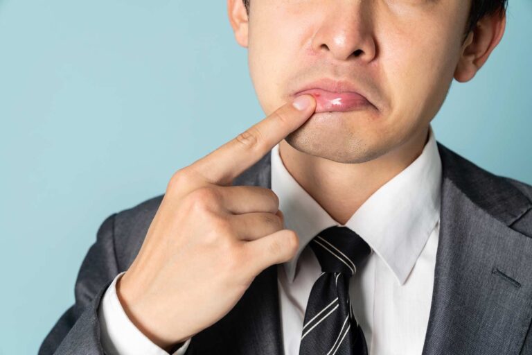 Les saignements des gencives cassent-ils le jeûne?